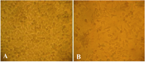 Figure 3. Cytotoxicity of Silver Nanoparticles (SN) syn-thesized from leaf of leaf of Suaeda  monoica on Hep2 cell line (A) Normal cells (B) SN treated cells (500 �g/ml) de-creased the viability of HeP-2 cells