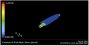 Figure 4.  Contours of wall shear stress (Pascal). Colors rep-resent wall shear stress levels (Blue, low, Yellow-Green, Intermediate) 