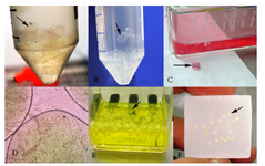 Figure 5. Preparation and culture of alginate/chondrocyte beads. Arrows indicate single bead. A) Polymerization of alginate/chondrocyte beads in CaCl2. B) Washing of alginate/ chondrocyte beads in NaCl. C) Culture of alginate/chon-drocyte beads in flask then in bioreactor. D) Invert micro-scopic observation of alginate/chondrocyte beads (three beads). E) Fixation of alginate/chondrocyte beads in bouin fixative. F) Embedding of alginate/ chondrocyte beads in paraffin wax 