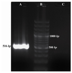 Figure 1. Amplification of APN using exon junction primers. A) 516 bp fragment amplified with exon junction primers, 
B) 100 bp DNA Ladder, C) Negative control
