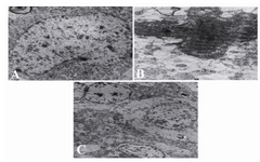 Figure 3. Electron micrograph of cortical neurons from in-tact, control, and WK pre-treated groups. Normal ultrastruc-ture is visible in intact neurons. Seizure results in severe de-generative changes in cortical neurons (part B). Cortical neurons from the WK pre-treated group show some degener-ative changes, but the whole ultrastructure was maintained (part C). Magnification in (A) and (B) is 8900 × and in (C) is 3900