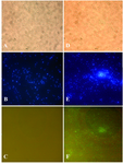 Figure 6. Indirect imunofluorescence analysis: (A, B, C), wild type cells; (D, E, F), transfected cells; (A, D), phase-contrast images; (B, E), DAPI staining, indicating the localization of DNA in the nucleus and kinetoplast in blue, and (C, F) FITC staining (green) using the anti-His tag monoclonal antibody diluted (1:40) for wild type and transfected cells ( 40).