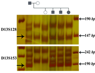 Figure 3. Linkage analysis in a family with retinoblastoma (Patient no. 200 is proband). The arrows show the markers which are linked to the mutant allele. The two microsatellite markers, D13S128 and D13S153 were informative, while D13S156 could not be used for linkage analysis in this family. The first lane of each gel is DNA size marker VIII (Roche) 